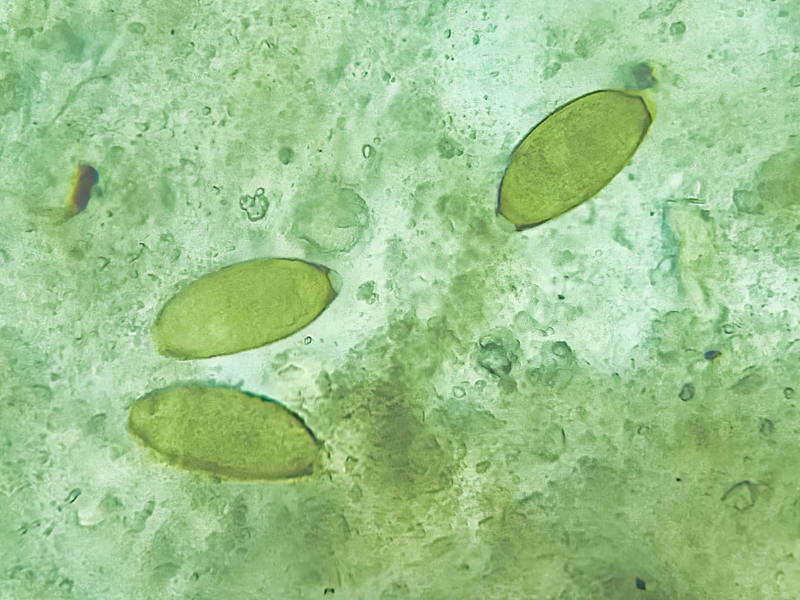 Batch of Capillaria Eggs