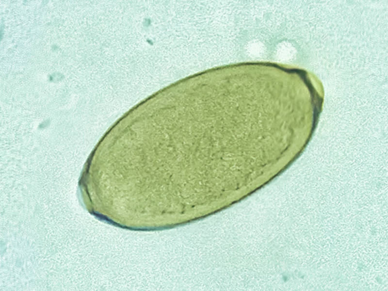 Single capillaria egg